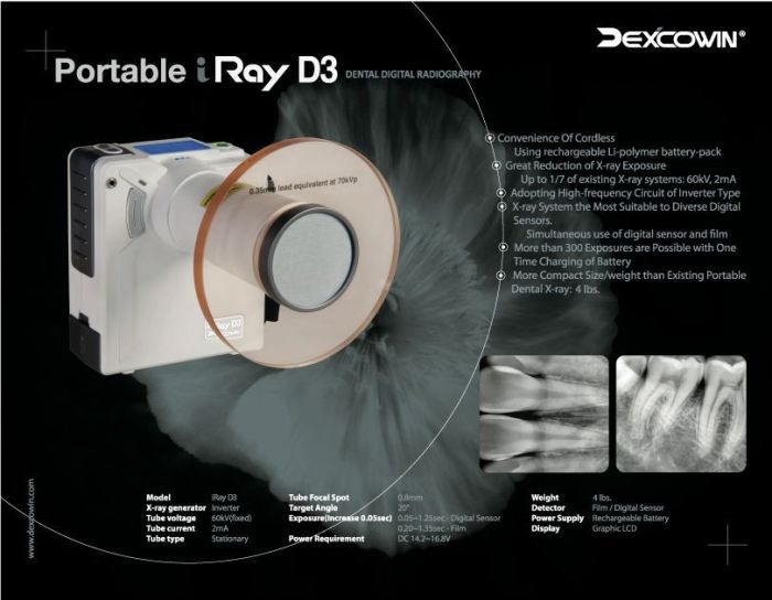 Portable X-Ray  Dexicown